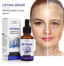 Load image into Gallery viewer, RETINOL - Beauty By Taghreed