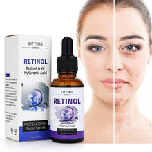Load image into Gallery viewer, RETINOL - Beauty By Taghreed